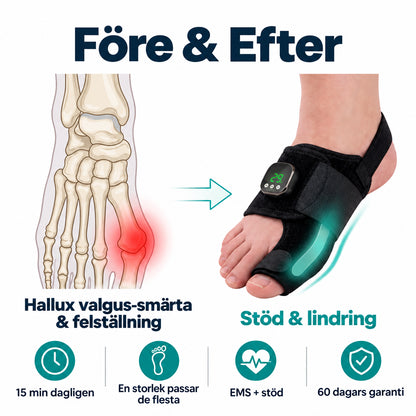 Fotiva™ EMS - Hallux Valgus-korrigerer
